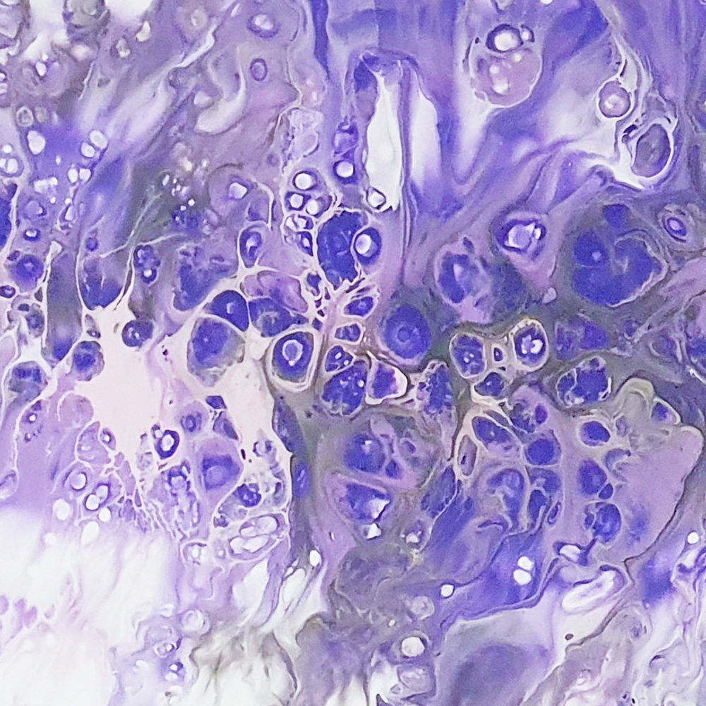 purple cloud 1 - 1